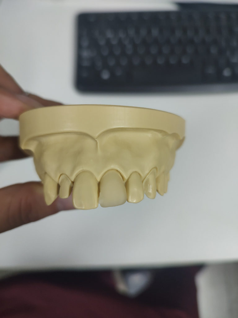 tecnologia en planificacion de rehabilitacion dentaria