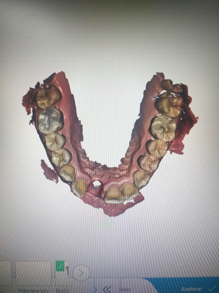tecnologia en planificacion de rehabilitacion dentaria